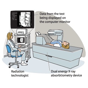 Bone Density Test Scarborough
